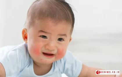mikrobiota usus anak