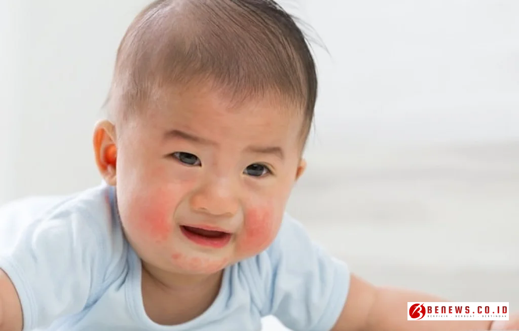 mikrobiota usus anak